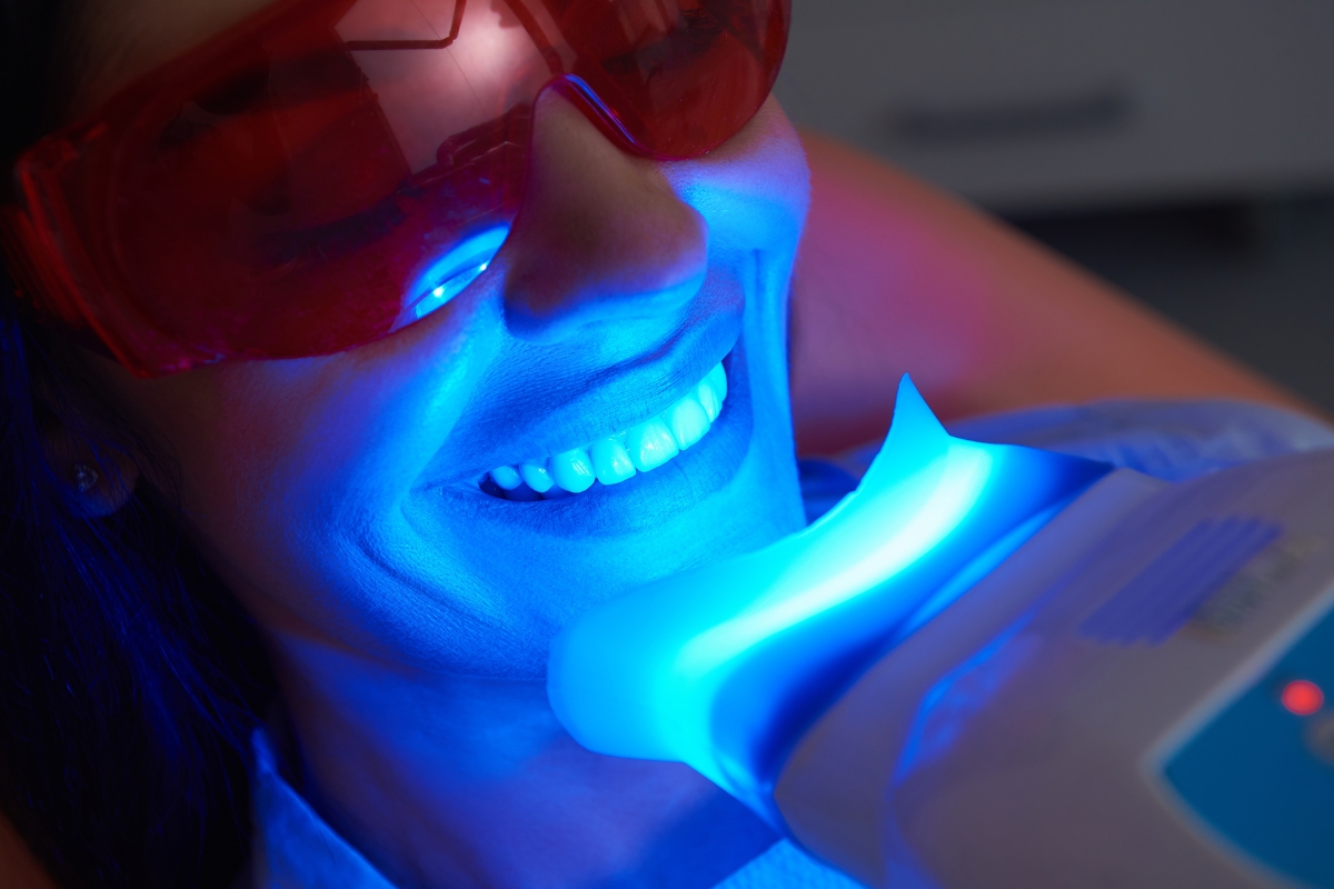 Teeth Whitening Treatment Sand Lake