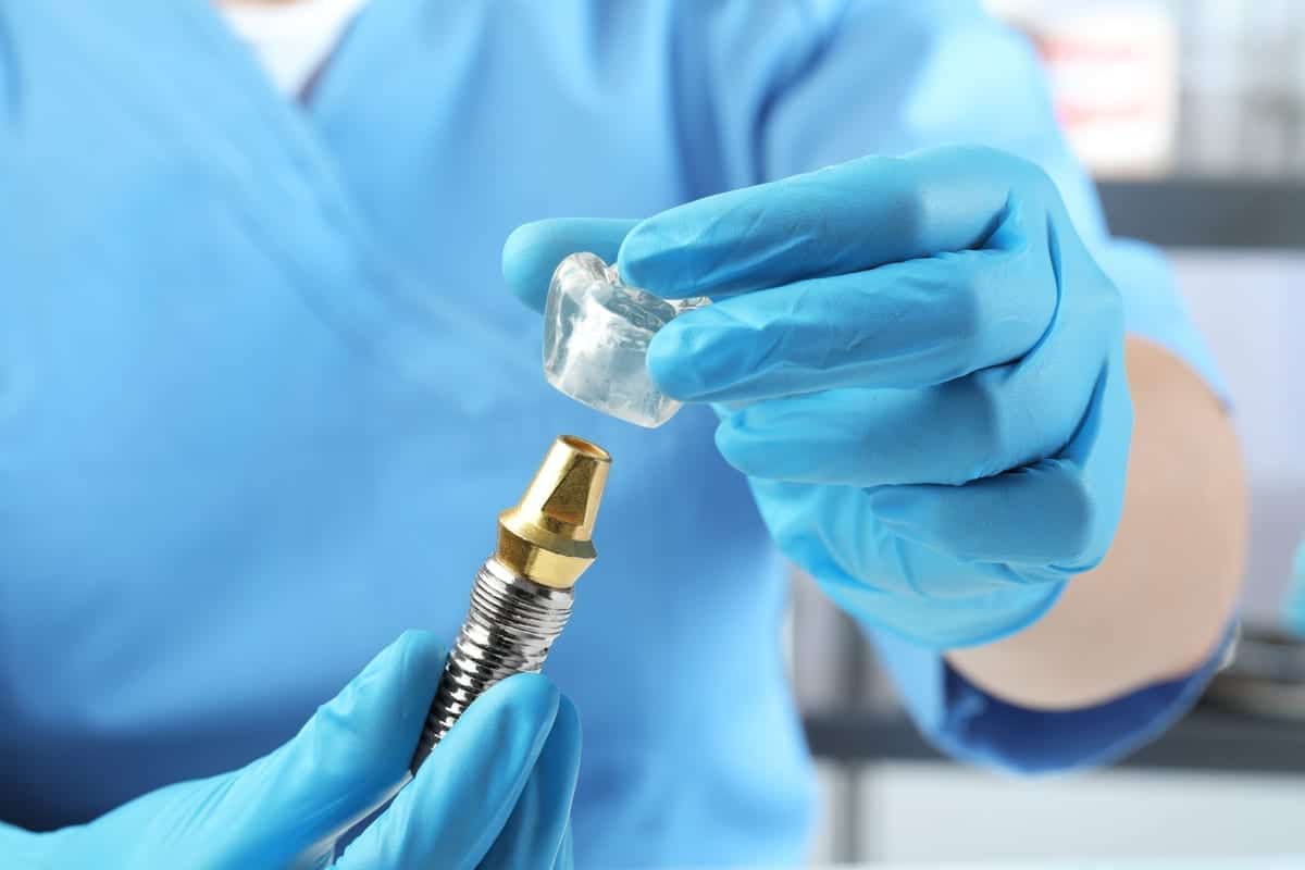 Dental Implants in Oak Ridge